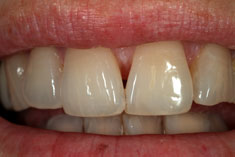Sabian Symbol Scorpio 9: Dental work.
