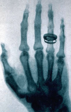 Sabian Symbol for Scorpio 25: An x-ray